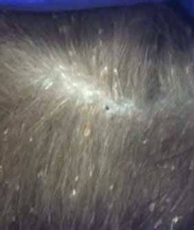 🪳EEK - LICE ALERT🪳 Ok. It's 💯 not the best video. But I still have to share it. At our Dec11 TNR clinic we had a patient with lice. I'd never seen a cat with lice and don't know why it surprised me - poor baby. Thankfully he was rescued so he could be treated (and neutered of course) at our clinic. 🪳🪳🪳🪳🪳🪳🪳🪳🪳 | Toronto Street Cats