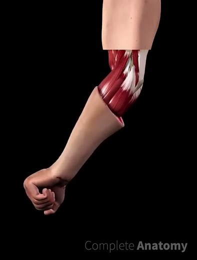 Tennis Elbow (Lateral Epicondylitis)