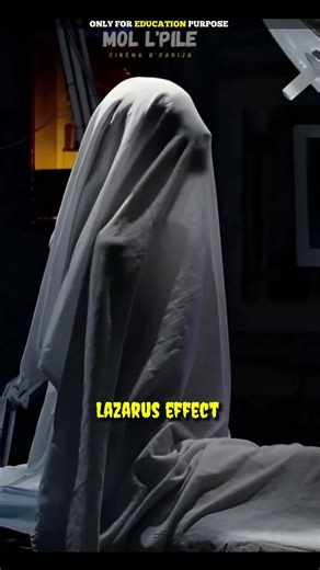 Why Dead Bodies Sometimes Move After Death | #shorts