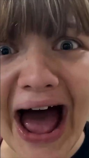 He’s Got 3 EYES!!!