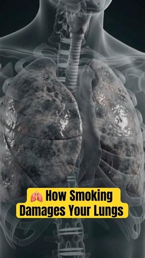 🫁 How Smoking Damages Your Lungs