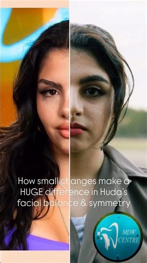 Before & After 🙃😳Transfomation😱😱 Amazing result👌