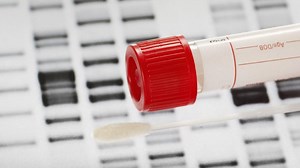 Personal DNA Testing