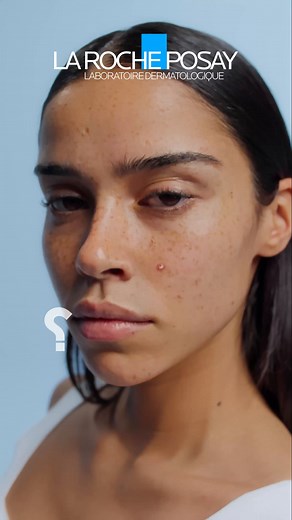 DON’T POP IT, PATCH IT! Meet the NEW Effaclar Duo M pimple patches from La Roche-Posay. Invisible on skin, and powered by hydrocolloid technology to absorb and protect. Clinically proven to start fading pimples in just 3 hours. ما تفرّقعهاش… حطلها باتش! جديد من لاروش بوزيه: EFFACLAR DUO M PATCH للحبوب. بسُمك 420 ميكرون، شفافة على البشرة، وبتكنولوجيا الهيدروكولويد اللي بتمتص وبتحمي. ومثبت فاعليتها إنها تبدأ تقلل مظهر الحبوب في 3 ساعات. | La Roche-Posay