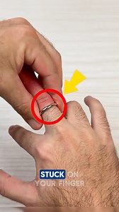 How to Safely Remove a Ring Stuck on Your Finger If a ring gets stuck on your finger, forcing it off can cause serious swelling or injury. This safe technique uses a simple string to reduce swelling and remove the ring gently. A must-know life hack for hand safety, emergency care, and preventing costly medical visits. Credits: Susan Tips /YT #fingerstyle #ring #ringstack #USA #tools | Daily Facts
