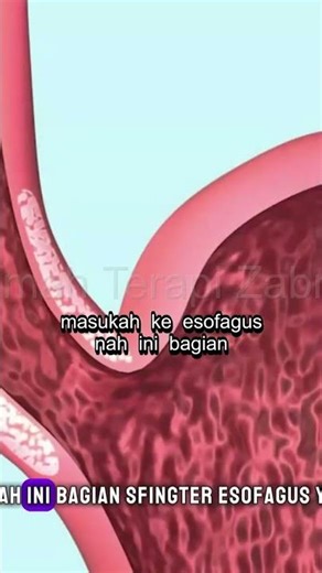 Katup Esofagus: Fungsi Penting yang Sering Diabaikan!