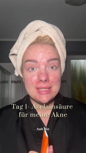 Ich gebe Azelainsäure nochmals eine Chance und werde es in meinem Gesicht gegen meine Akne und Pickelmale verwenden. Dieses Mal achte ich allerdings sehr akribisch auf meine Hautbarriere, wodurch ich dann hoffentlich einen baldigen Erfolg haben werde. Drückt mir die Daumen & folgt mir gerne um weitere Updates nicht zu verpassen👉🏼 #azelaicacid #haut #pickel #akne #derma