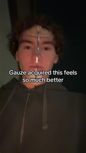 #headgear #orthodontics #rpe #airwayorthodontics #gauze