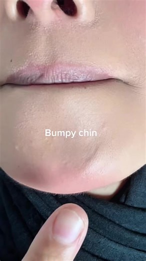 Double Cleanse for Glowy Skin with SKIN1004MY