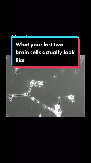 Neurons Firing Time Lapse Video