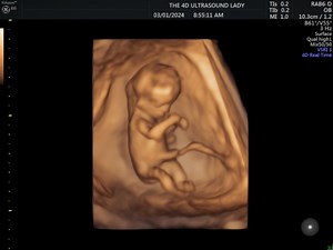 256K views · 769 reactions | How amazing is this 12 week old baby!?! So active  | The 4D Ultrasound Lady | Facebook