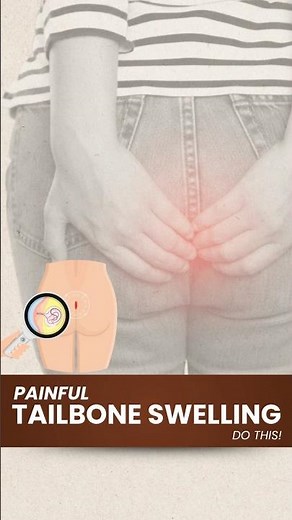 Is Laser Hair Removal the BEST Option for Pilonidal Cyst Treatment?