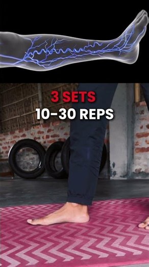Varicose Vein Relief: 5 Easy Moves for Better Circulation