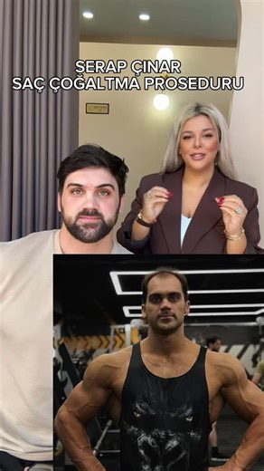 🔬 Nano Hücre Teknolojisi (Nano Cell Technology) Nano hücre teknolojisi, aktif bileşenlerin moleküler boyutlarını nanometre seviyesine kadar küçülterek saç derisine ve folikül köklerine daha derin, hızlı ve etkili nüfuz etmesini sağlayan ileri düzey bir mikrotaşıyıcı sistemidir. Bu teknoloji sayesinde, bitkisel yağlar ve vitamin kompleksleri saç derisinde yalnızca yüzeyde kalmaz, folikül çevresindeki hücre zarlarından geçerek doğrudan kök hücre aktivasyon bölgesine ulaşır. Bilimsel etkileri: • H