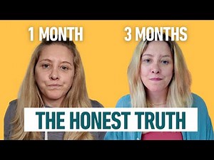 3 Months After My Facelift: What Healing Really Looks Like