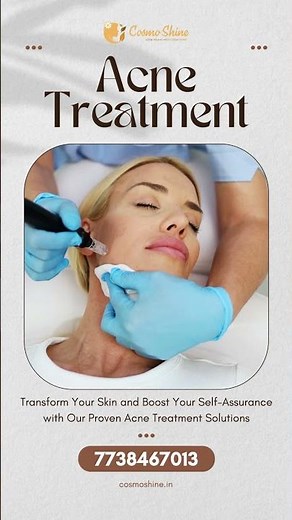 How to Get Rid of Acne Fast | Best Acne Treatment for Clear Skin