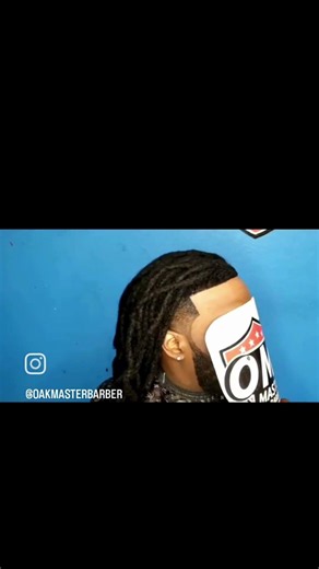 INSANE Balding To Dreadlocks Transformation! Custom Hair Unit 🤯🔥