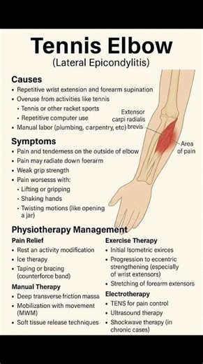 Tennis Elbow (Lateral Epicondylitis) | Physiotherapy Management|| #physiotherapy #physiotherapist