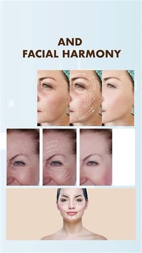 Fat Grafting for Face | Restore Volume Naturally | Anti-Aging Treatment by Dr Mathew PC