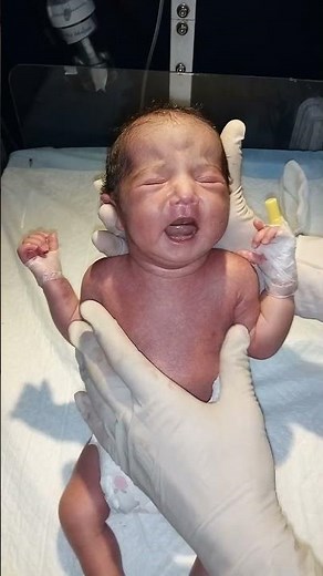 Crying Baby Moment #firstbreath #neonatologist #newborncare #babycare #newborn #babydigestion #cute