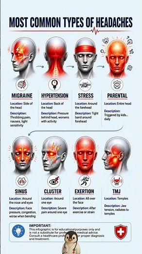 8 Common Headache Types & What They Mean 🤕🧠