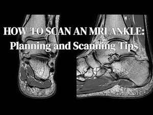 MRI Ankle Scan