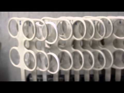 Looking Inward: Treating Convergence Insufficiency (CI) with Vision Therapy | Wow Vision Therapy