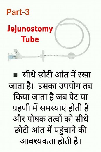 Jejunostomy Tube part-3 Medical Equipment