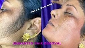1.8M views · 8.1K reactions | Stop shaving! This is the easiest way to remove facial and body hair without pain | Natural Beauty Remedy | Facebook