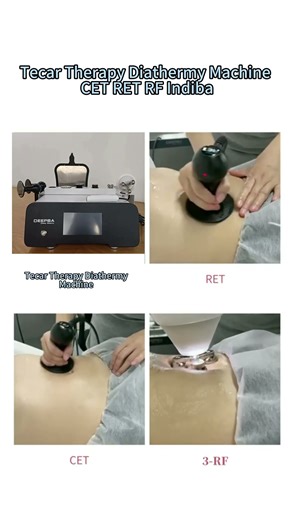Tecar Therapy Diathermy Machine CET RET RF Indiba