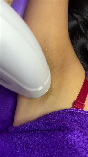 အမွှေးမျှင်တွေကို ဖယ်ရှားပေးမဲ့ Hair Laser Treatment လေးနဲ့ ဖြူဝင်းတဲ့ ဂျိုင်းသားလေးရဖို့အတွက် Brightening Carbon Treatment လေးကို Pinky မှာ နောက်ဆုံးပေါ်စက်တွေနဲ့ပြုလုပ်ပေးနေပါတယ်ရှင့်