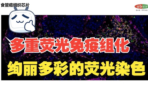 多重荧光免疫组化——绚丽多彩的荧光染色