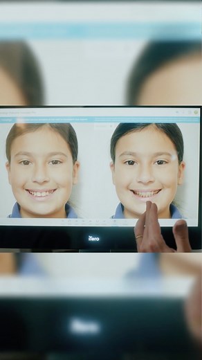 11 reactions | Seeing is believing. ​ ​Invisalign® Outcome...