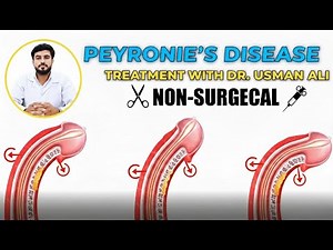 Peyronie’s Disease Treatment Without Surgery | Dr. Usman Ali | Non-Surgical Solution for Bent Penis