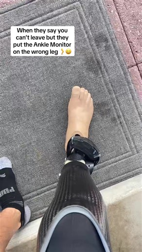 Life with an Ankle Monitor #amputee #funny #jokes #darkhumour #anklet | ankle monitors