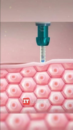 Needle Free Medicine Injector