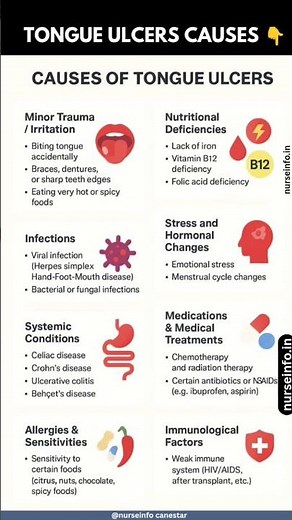CAUSES OF TONGUE ULCERS #tongueulcers