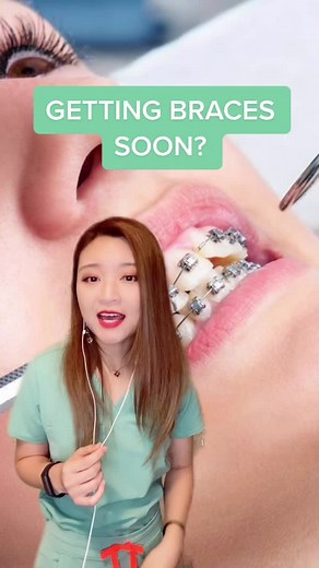 Essential things to know before getting braces! #braces#dentist#orthodontist#fyp#teeth#bracestips