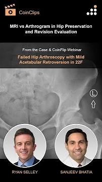 MRI vs Arthrogram in Hip Preservation and Revision Evaluation