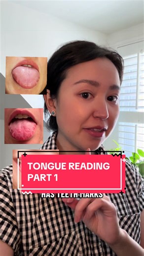 Understanding Tongue Reading in Chinese Medicine