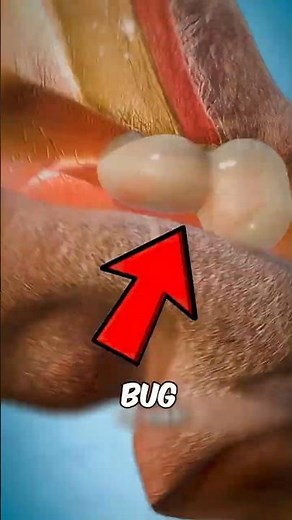 You Won't Believe What Could Be Hiding Inside Your Ear!
