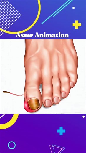 foot cleaning and treatment asmr animation #asmr #animation #foottreatment #cleaning #vairal