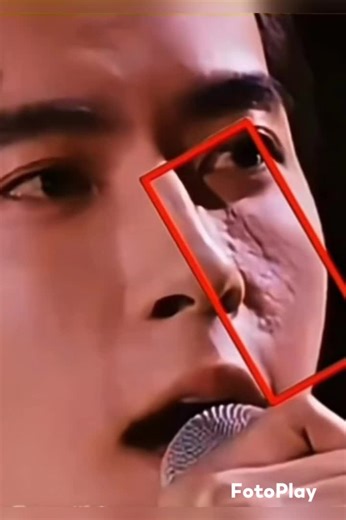 Giustizia per Yu: Le Ferite Nascoste Sono Visibili