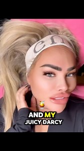 Darcey Silva's Never-Ending Botox Journey: Juicy Lips and Relentless Reinvention‼️ ✨✨🙏 #90day | Loren & Alex - 90 Day Fiance
