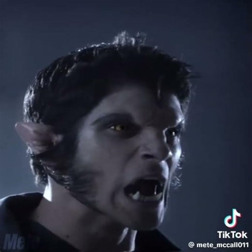 Alpha Pack Vs Scott McCall