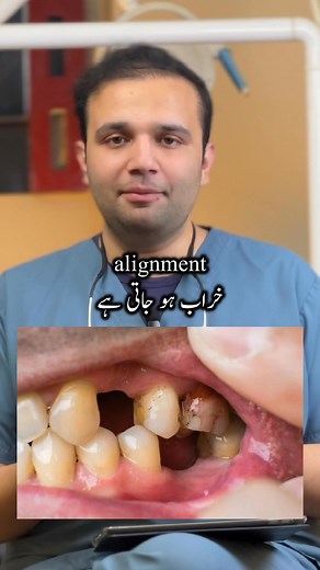 🦷Lost a tooth? Replace it early! When a tooth is missing, the neighboring teeth begin to tilt into that space, disturbing your bite and the way your upper and lower teeth meet. This can eventually lead to long-term alignment and chewing problems. Early replacement helps maintain balance, function, and a healthy smile.✨ #TheDentalLounge #DrZaraKhan #ToothReplacement #PeshawarDentist #SmileCare #dentalawareness | Dr Zarak Khan - TDL