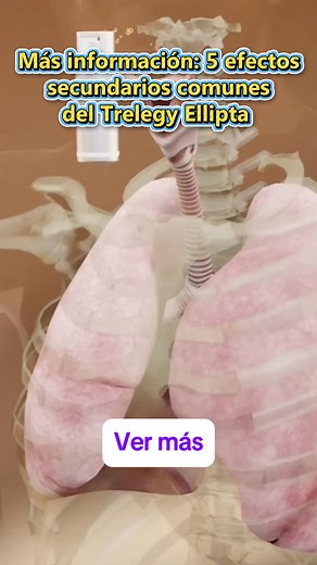 Más información: 5 efectos secundarios comunes del Trelegy Ellipta (Trelegy Inhaler). Más información: | Health Center