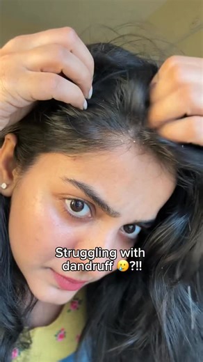 Haritha K Nambiar | I love this shampoo😍, comment “HAIR”❤️ . . . . . . [Anti dandruff shampoo, Anti dandruff shampoo, Salicylic acid shampoo, dandruff,... | Instagram