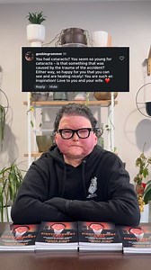 Joe gets this question a lot so here is the honest answer. Yes Joe developed cataracts at a young age. This was not random. After his face and double hand transplant he has to take lifelong steroids and immunosuppressants to prevent his body from rejecting his transplanted face and hands. Long term steroid use is a known cause of cataracts even in young patients. On top of that Joe also had direct corneal damage from the flames during the accident which further impacted his vision. The cataract 