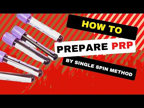 Platelet-Rich Plasma (PRP) for Knee Osteoarthritis: Single Spin Method | Step-by-Step Guide